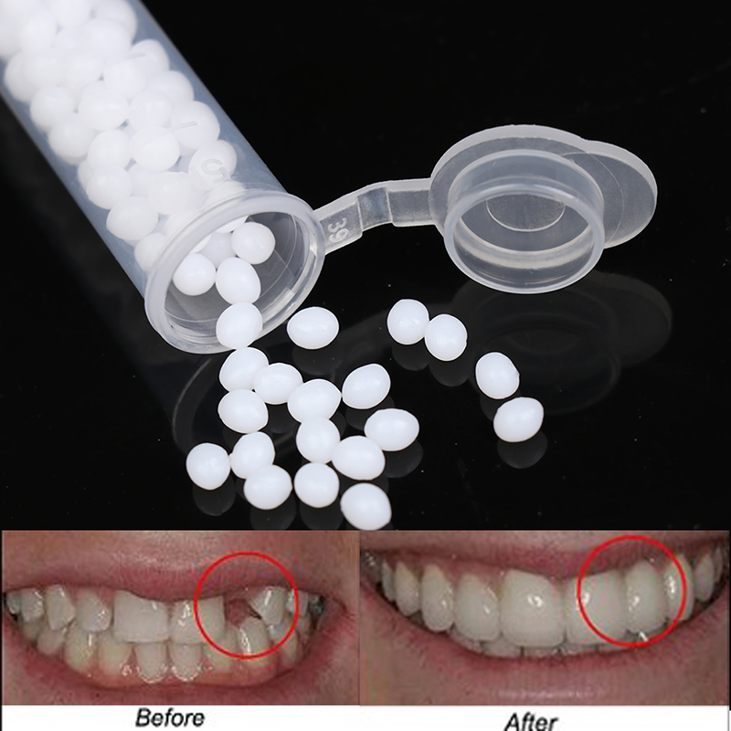【K】1 коробка набора для времен – обзор и цена Teeth Whitening Kit